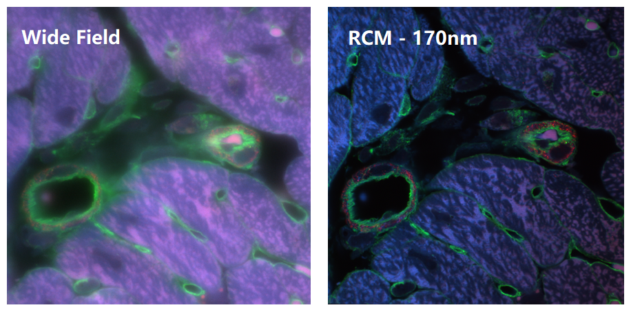 宽场和RCM的对比-2.png